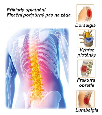 obsah06-spine-syndroms.jpg